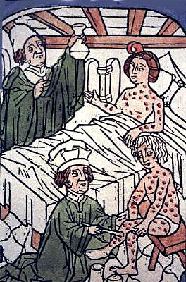 plaatje syfilis in de middeleeuwen